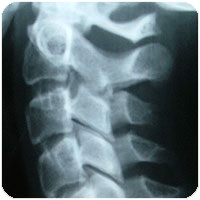injury.jpg