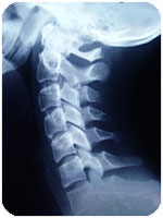 x-ray_neck.jpg