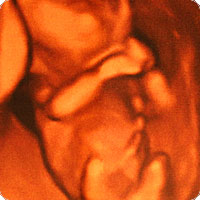 embryo-bs1027324.jpg